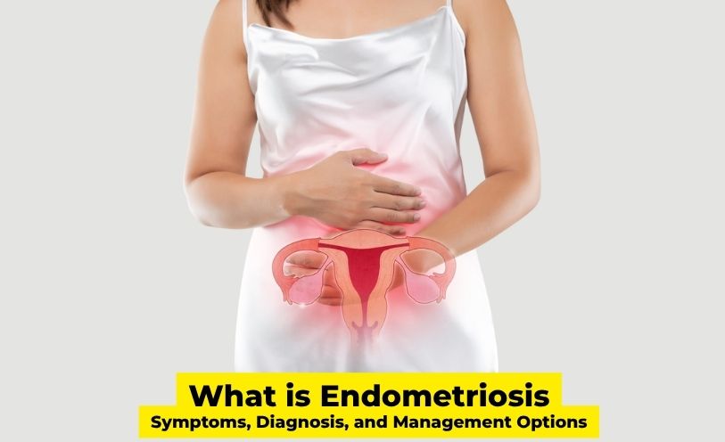 Endometriosis