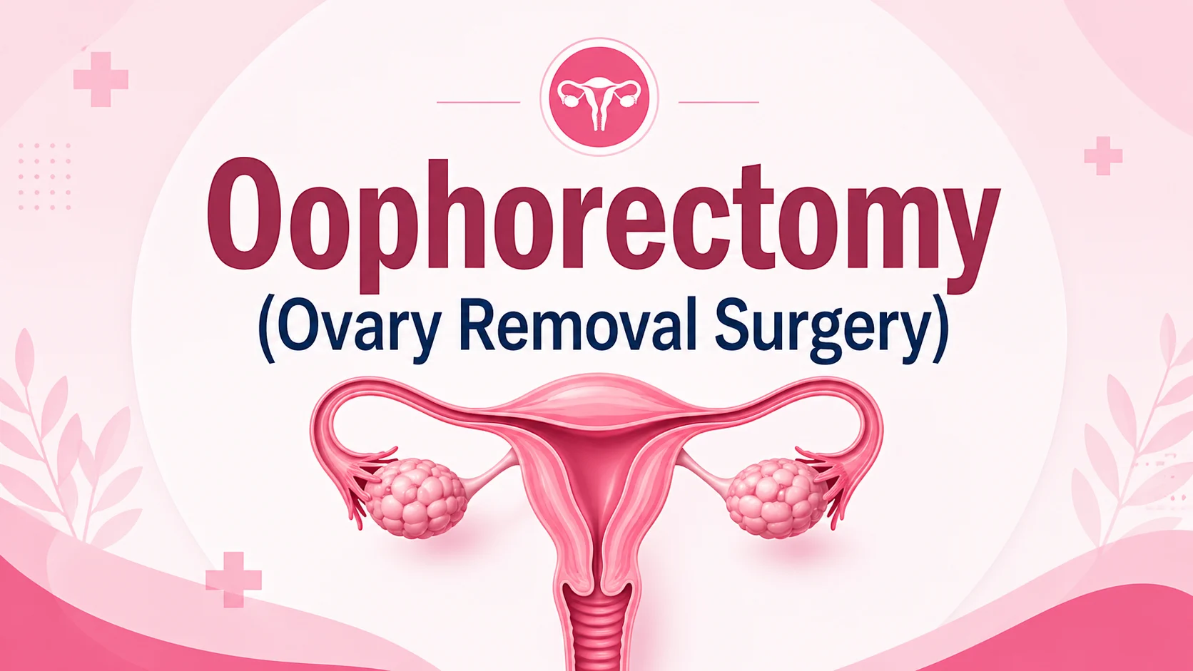 Oophorectomy Ovary Removal Surgery